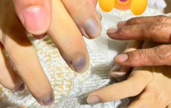 Kematian Winda Lorenza Gowasa Janggal, LBH Medan Duga Kematiannya Bukan Bunuh Diri Melainkan Ada Dugaan Tundak Pidana