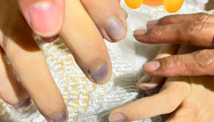Kematian Winda Lorenza Gowasa Janggal, LBH Medan Duga Kematiannya Bukan Bunuh Diri Melainkan Ada Dugaan Tundak Pidana