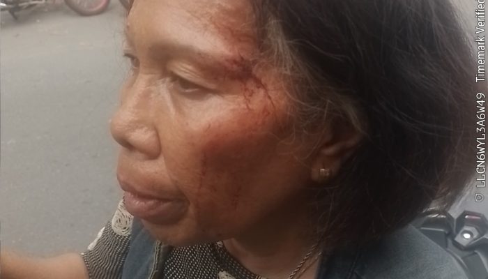 Diduga Alami Penganiayaan di Depan Tiara Convention Center, Emperi Lince Silitonga Laporkan Puput ke Polrestabes Medan